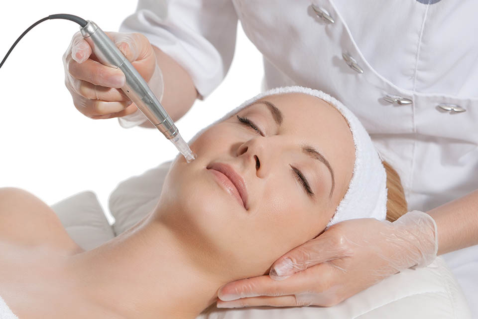 Microneedling